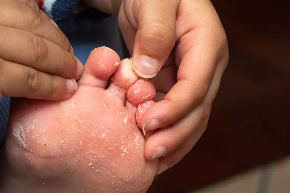 a close up of a person's hands holding a foot